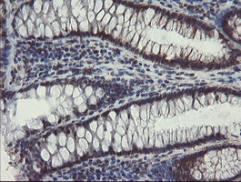 IHC of paraffin-embedded Human colon tissue using anti-SKIL mouse monoclonal antibody.