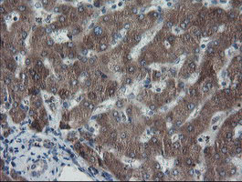 IHC of paraffin-embedded Human liver tissue using anti-SKIL mouse monoclonal antibody.