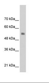 Daudi Cell Lysate