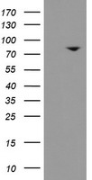HEK293T cells were transfected with the pCMV6-ENTRY control (Left lane) or pCMV6-ENTRY SKIL (Right lane) cDNA for 48 hrs and lysed. Equivalent amounts of cell lysates (5 ug per lane) were separated by SDS-PAGE and immunoblotted with anti-SKIL.
