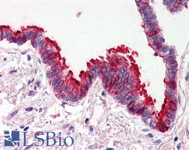 Anti-SKIL antibody IHC of human lung, respiratory epithelium. Immunohistochemistry of formalin-fixed, paraffin-embedded tissue after heat-induced antigen retrieval. Antibody LS-B553 concentration 5 ug/ml.