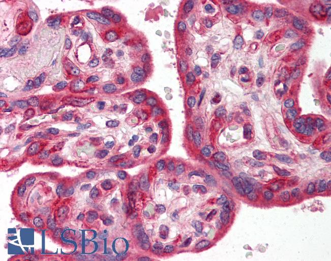 Anti-SKIL antibody IHC of human placenta. Immunohistochemistry of formalin-fixed, paraffin-embedded tissue after heat-induced antigen retrieval. Antibody LS-B553 concentration 5 ug/ml.