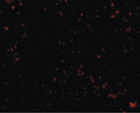 Immunofluorescence of SnoN in Mouse Lung cells with SnoN antibody at 20 ug/ml.