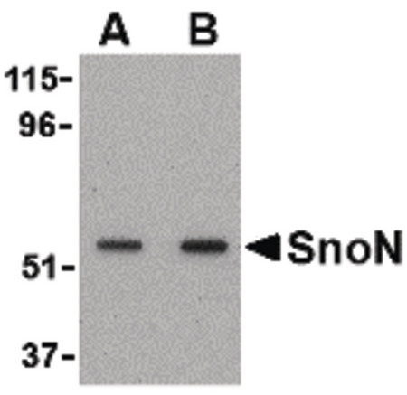 Western blot of SnoN in A431 cell lysate with SnoN antibody at (A) 0.5 and (B) 1 ug/ml.