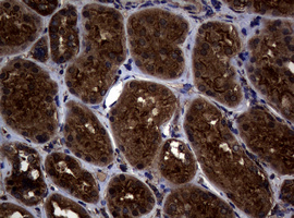 IHC of paraffin-embedded Human Kidney tissue using anti-SKIL mouse monoclonal antibody.
