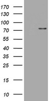 HEK293T cells were transfected with the pCMV6-ENTRY control (Left lane) or pCMV6-ENTRY SKIL (Right lane) cDNA for 48 hrs and lysed. Equivalent amounts of cell lysates (5 ug per lane) were separated by SDS-PAGE and immunoblotted with anti-SKIL.