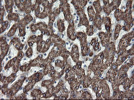 IHC of paraffin-embedded Human liver tissue using anti-SKIL mouse monoclonal antibody.