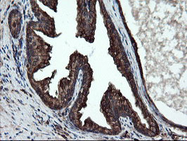 IHC of paraffin-embedded Human prostate tissue using anti-SKIL mouse monoclonal antibody.