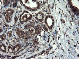 IHC of paraffin-embedded Human breast tissue using anti-SKIL mouse monoclonal antibody.