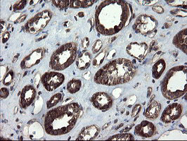 IHC of paraffin-embedded Human Kidney tissue using anti-SKIL mouse monoclonal antibody.
