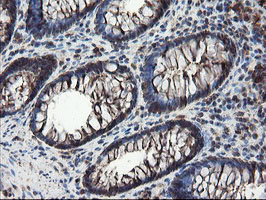 IHC of paraffin-embedded Human colon tissue using anti-SKIL mouse monoclonal antibody.