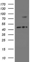 HEK293T cells were transfected with the pCMV6-ENTRY control (Left lane) or pCMV6-ENTRY SKIL (Right lane) cDNA for 48 hrs and lysed. Equivalent amounts of cell lysates (5 ug per lane) were separated by SDS-PAGE and immunoblotted with anti-SKIL.