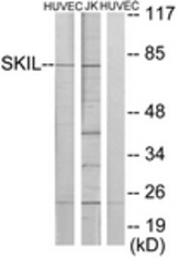 Western blot of extracts from HUVEC/Jurkat cells, using SKIL Antibody. The lane on the right is treated with the synthesized peptide.