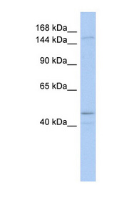 SKIV2L antibody LS-C110151 Western blot of COLO205 cell lysate.