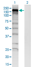 Western Blot analysis of SKIV2L expression in transfected 293T cell line by SKIV2L monoclonal antibody (M05), clone 1E5.Lane 1: SKIV2L transfected lysate (Predicted MW: 137.06 KDa).Lane 2: Non-transfected lysate.