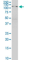 SKIV2L monoclonal antibody (M05), clone 1E5. Western Blot analysis of SKIV2L expression in HeLa NE.