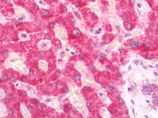 Human Liver: Formalin-Fixed, Paraffin-Embedded (FFPE)