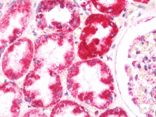 Human Kidney: Formalin-Fixed, Paraffin-Embedded (FFPE)
