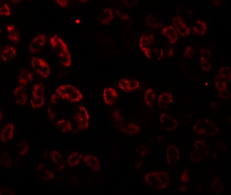 Immunofluorescence of SKI2W in human stomach tissue with SKI2W antibody at 20 ug/ml.
