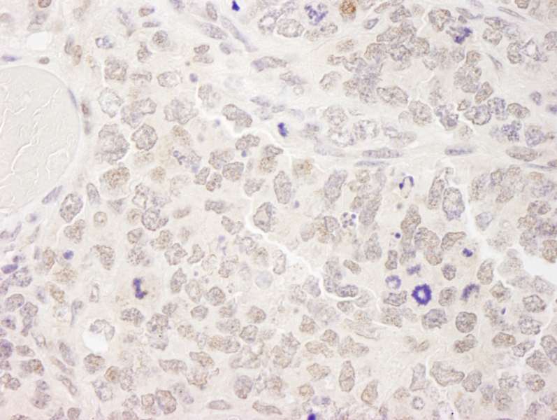 Detection of Mouse SKIV2L2 by Immunohistochemistry. Sample: FFPE section of mouse teratoma. Antibody: Affinity purified rabbit anti-SKIV2L2 used at a dilution of 1:250. Epitope Retrieval Buffer-High pH (IHC-101J) was substituted for Epitope Retrieval Buffer-Reduced pH.