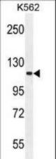 FUSSEL18 Antibody western blot of K562 cell line lysates (35 ug/lane). The FUSSEL18 antibody detected the FUSSEL18 protein (arrow).
