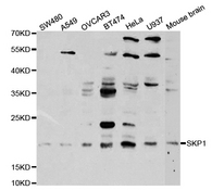 Western blot analysis of extracts of various cell lines, using SKP1 antibody.