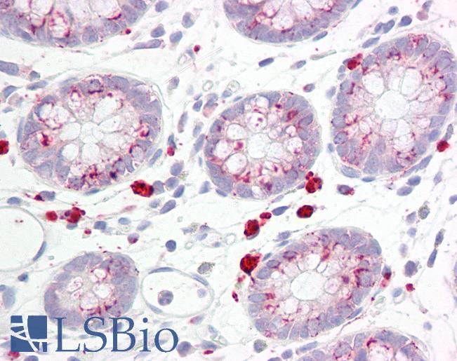 Anti-SKP1 antibody IHC of human colon. Immunohistochemistry of formalin-fixed, paraffin-embedded tissue after heat-induced antigen retrieval. Antibody LS-B7623 concentration 10 ug/ml.
