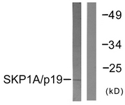 Western blot of extracts from COS7 cells, using SKP1A/p19 Antibody. The lane on the right is treated with the synthesized peptide.