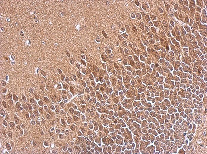IHC of paraffin-embedded CL1-5 xenograft, using SKP1 antibody at 1:500 dilution.