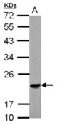 Sample (30 ug of whole cell lysate) A: NIH-3T3 12% SDS PAGE SKP1 antibody diluted at 1:3000