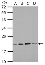 Sample (30 ug of whole cell lysate) A: A549 B: H1299 C: HCT116 D: MCF-7 12% SDS PAGE SKP1 antibody diluted at 1:1000
