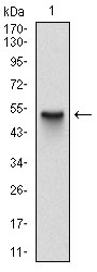 Western blot using SKP1 monoclonal antibody against human SKP1 (AA: 1-160) recombinant protein. (Expected MW is 43.5 kDa)