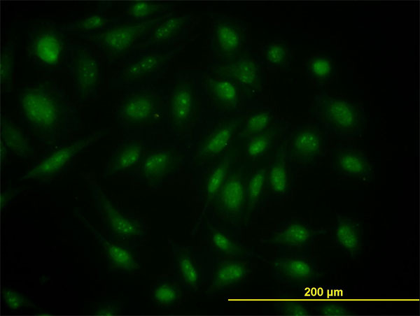 Immunofluorescence of monoclonal antibody to SKP1A on HeLa cell. [antibody concentration 10 ug/ml]
