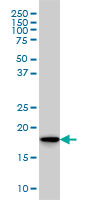SKP1A monoclonal antibody (M01), clone 1H8 Western Blot analysis of SKP1A expression in HeLa.