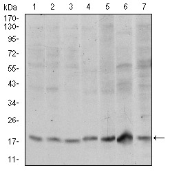 Western blot using SKP1 mouse monoclonal antibody against HeLa (1), RAJI (2), Jurkat (3), MCF-7 (4), HepG2 (5), PC-12 (6) and Cos7 (7) cell lysate.