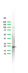 Western blot of SKP1 antibody
