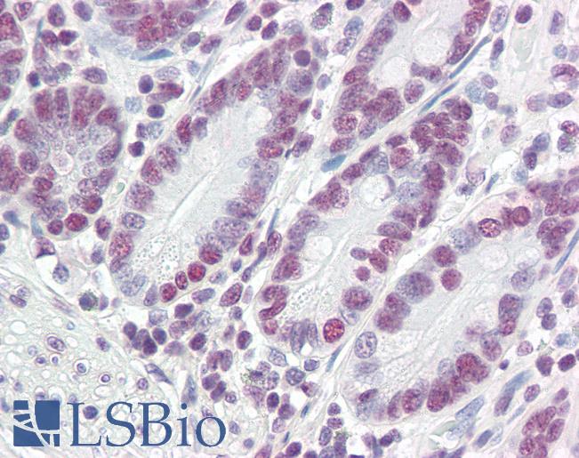 Anti-PTBP1 antibody IHC of human small intestine. Immunohistochemistry of formalin-fixed, paraffin-embedded tissue after heat-induced antigen retrieval. Antibody LS-B3235 concentration 5 ug/ml.
