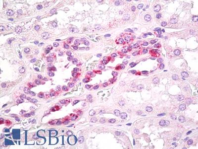 Anti-SLA antibody IHC of human kidney. Immunohistochemistry of formalin-fixed, paraffin-embedded tissue after heat-induced antigen retrieval. Antibody LS-B7959 dilution 15 ug/ml.
