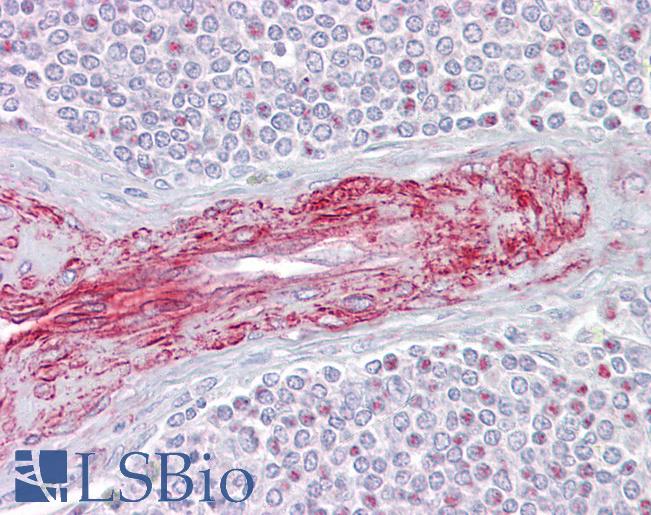 Anti-SLA antibody IHC of human spleen. Immunohistochemistry of formalin-fixed, paraffin-embedded tissue after heat-induced antigen retrieval. Antibody LS-B6827 concentration 5 ug/ml.