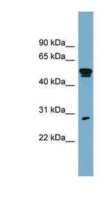SLA antibody LS-B6827 Western blot of OVCAR-3 cell lysate.