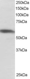 Antibody staining (1 ug/ml) of Jurkat lysate (RIPA buffer, 30 ug total protein per lane). Primary incubated for 1 hour. Detected by Western blot of chemiluminescence.