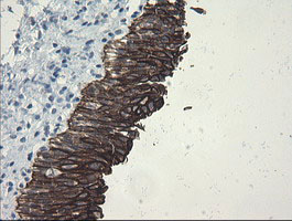 IHC of paraffin-embedded Human bladder tissue using anti-SLA2 mouse monoclonal antibody.