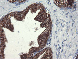 IHC of paraffin-embedded Human prostate tissue using anti-SLA2 mouse monoclonal antibody.