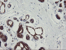 IHC of paraffin-embedded Human breast tissue using anti-SLA2 mouse monoclonal antibody.