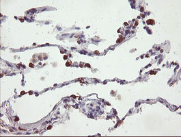 IHC of paraffin-embedded Human lung tissue using anti-SLA2 mouse monoclonal antibody.
