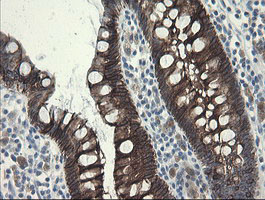 IHC of paraffin-embedded Human colon tissue using anti-SLA2 mouse monoclonal antibody.