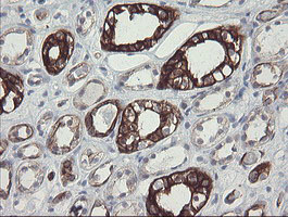 IHC of paraffin-embedded Human Kidney tissue using anti-SLA2 mouse monoclonal antibody.