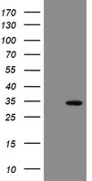 HEK293T cells were transfected with the pCMV6-ENTRY control (Left lane) or pCMV6-ENTRY SLA2 (Right lane) cDNA for 48 hrs and lysed. Equivalent amounts of cell lysates (5 ug per lane) were separated by SDS-PAGE and immunoblotted with anti-SLA2.