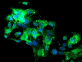 Anti-SLA2 mouse monoclonal antibody immunofluorescent staining of COS7 cells transiently transfected by pCMV6-ENTRY SLA2.