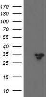 HEK293T cells were transfected with the pCMV6-ENTRY control (Left lane) or pCMV6-ENTRY SLA2 (Right lane) cDNA for 48 hrs and lysed. Equivalent amounts of cell lysates (5 ug per lane) were separated by SDS-PAGE and immunoblotted with anti-SLA2.
